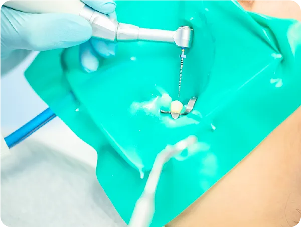 ラバーダムを使用している様子