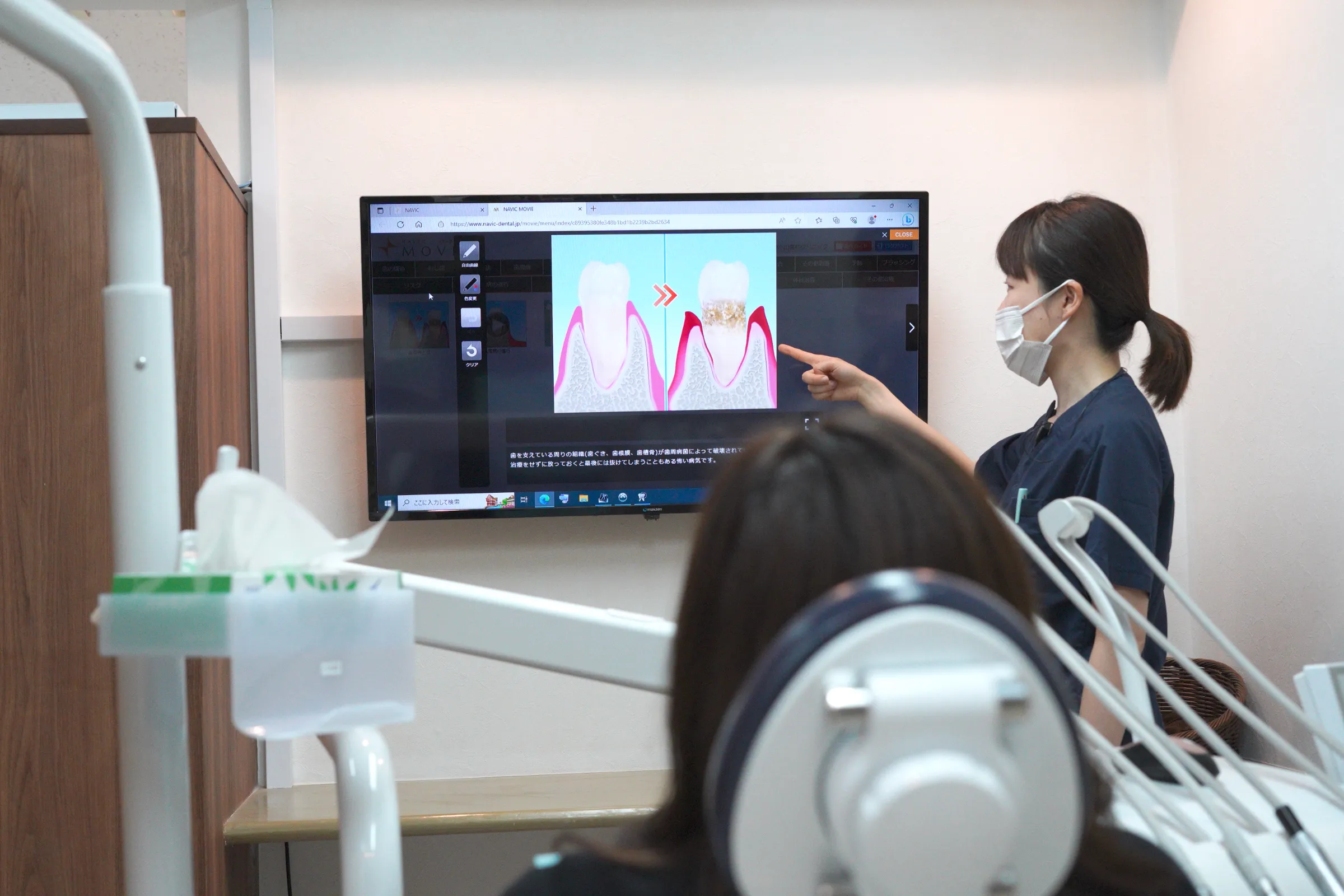 モニターを指差して患者さんに説明している女性歯科医